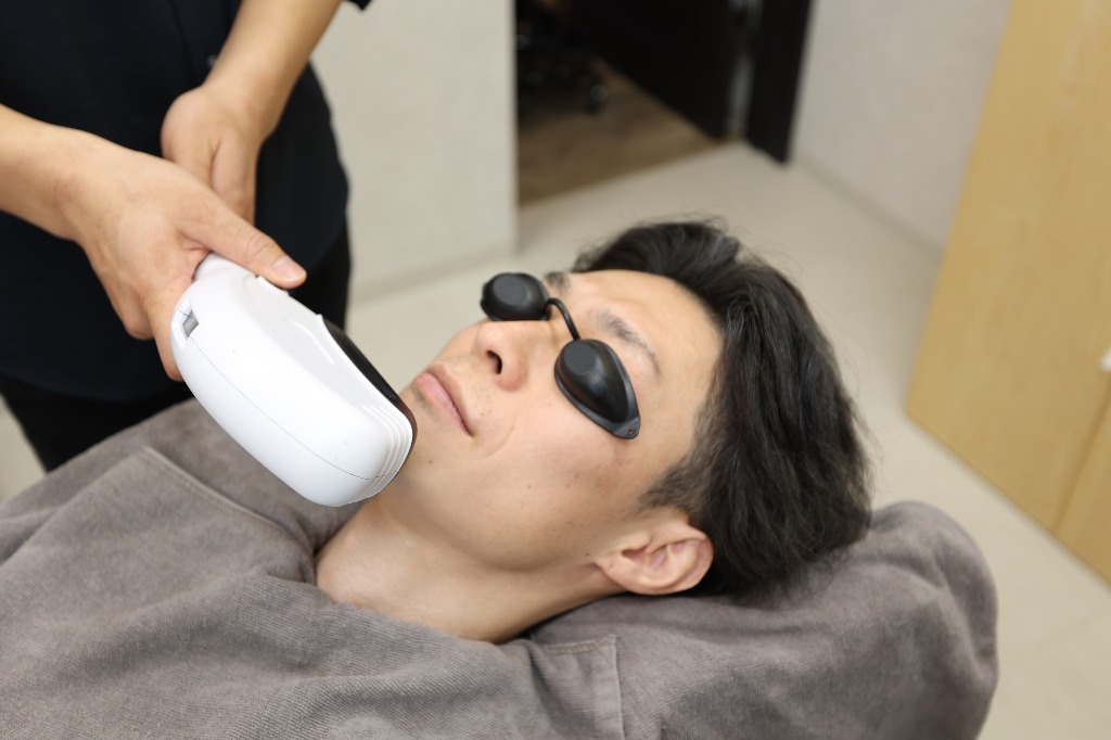 ヒゲ光脱毛について